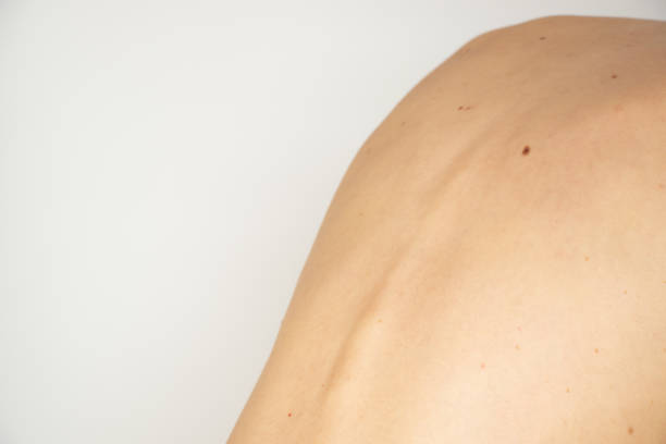 istock The back of a young thin girl on a white background without retouching and processing, medicine and body 1469268496