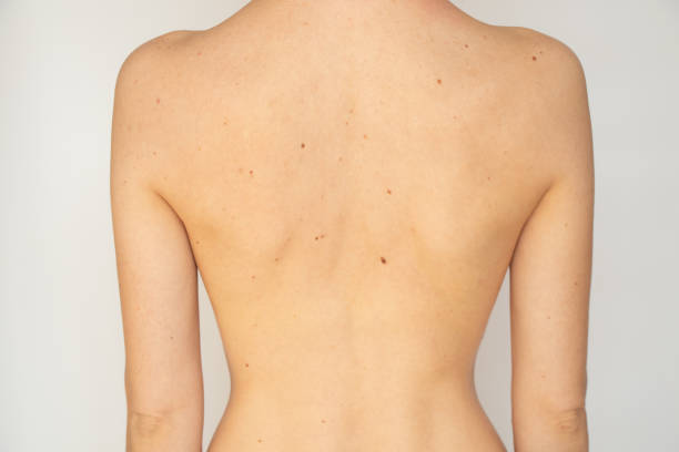 The back of a young thin girl on a white background without retouching and processing, medicine and body stock photo