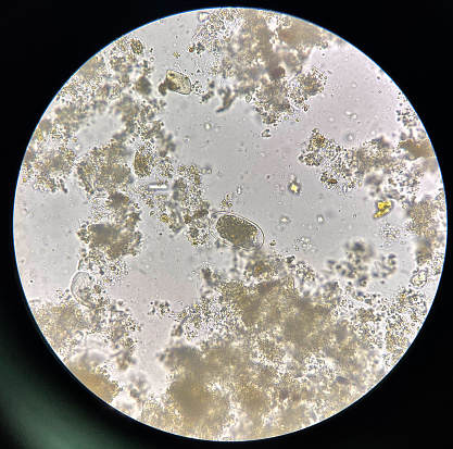 Hookworm egg human parasite in stool examination test find microscope 40x.