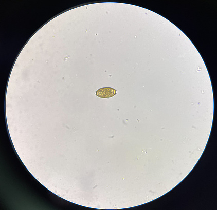trichuris trichiura egg  egg human parasite in stool examination test find microscope 40x.