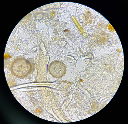 hymenolepis diminuta egg human parasite in stool examination test find microscope 40x.