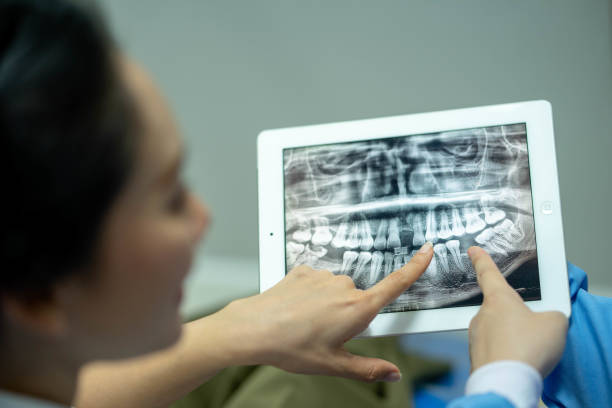 istock Panoramic Dental X-Ray with hand pointing at tablet screen and film 1469368988