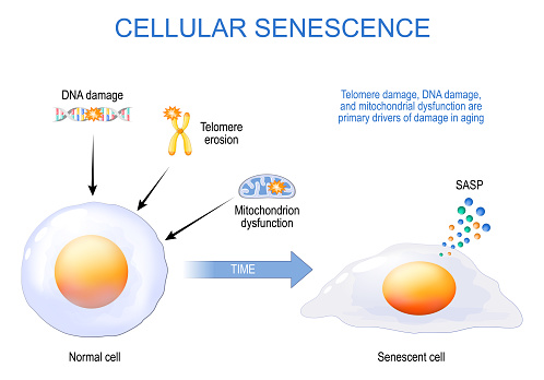 cellular senescence. From Normal to Senescent cell. Telomere and DNA damaged, mitochondrial dysfunction are primary drivers of damage in aging. Anti-aging therapy. Senescence-associated secretory phenotype SASP. Anti aging medicine. vector poster