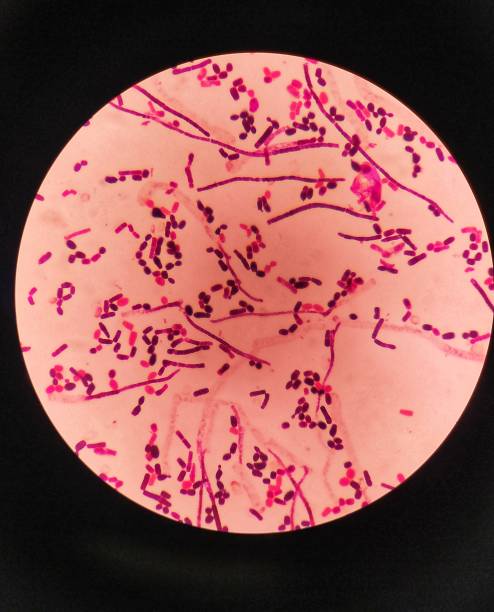 istock yeast cells and hyphae in gram stain fine with microscope. 1469443857