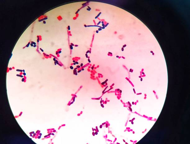 istock yeast cells and hyphae in gram stain fine with microscope. 1469445488