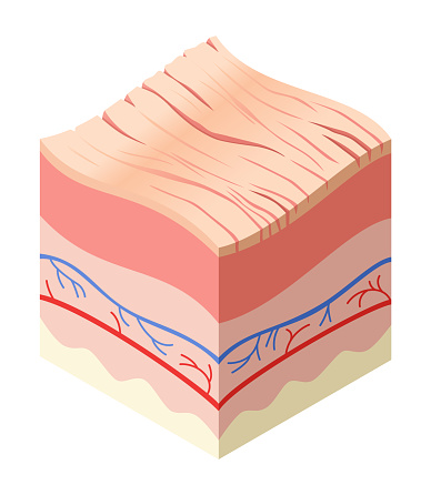 Skincare medical concept. Problems in cross-section of human skin horizontal layers structure. Anatomy illustrative model unhealthly layer of skin.