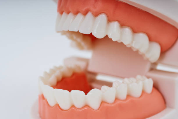 istock Dental model and white background 1469508119