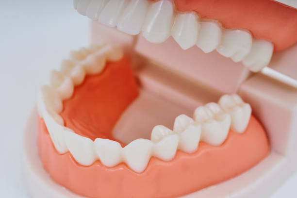 istock Dental model and white background 1469508135
