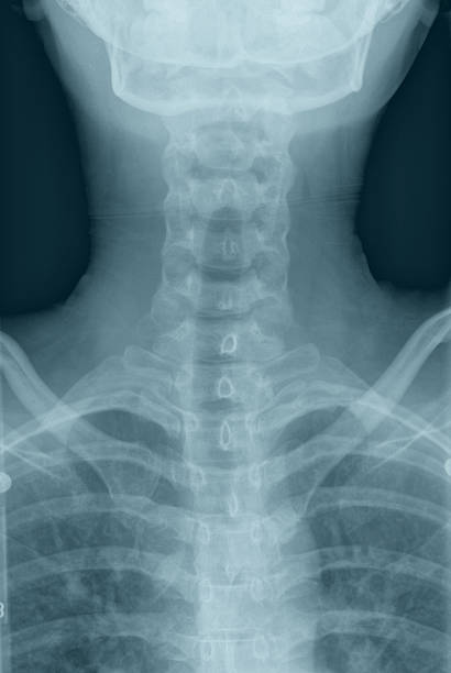 вырезом x ray - human spine human bone human vertebra rib cage стоковые фото и изображения