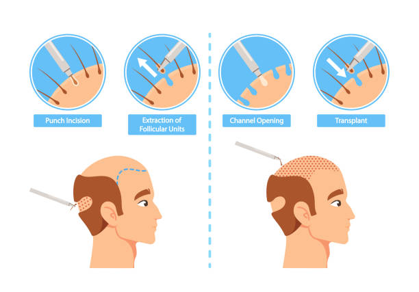 1,009 Hair Loss Before After Stock Photos, Pictures & Royalty-Free Images -  iStock | Balding