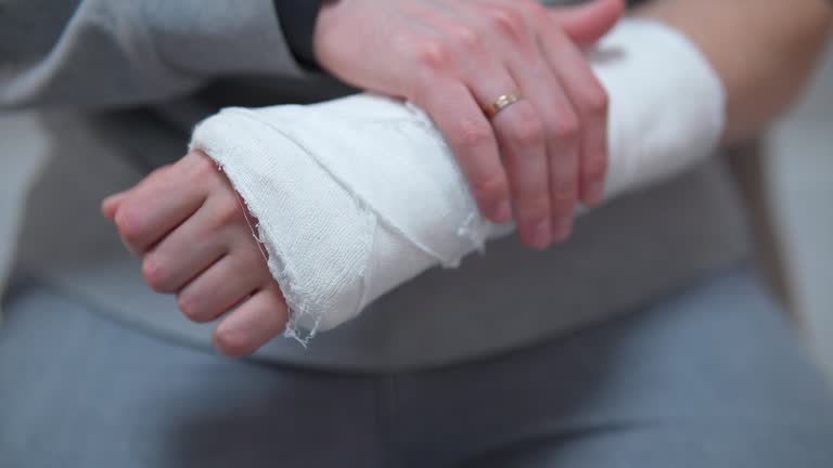 Man with plaster cast on arm. The difficulty of self-movement of the hand at a fracture. Painful heavy movements of broken finger hands close-up.