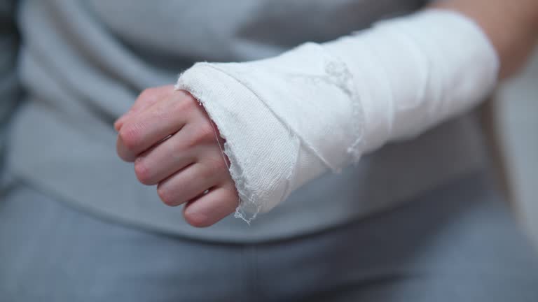 Man with plaster cast on arm. The difficulty of self-movement of the hand at a fracture. Painful heavy movements of broken finger hands close-up.