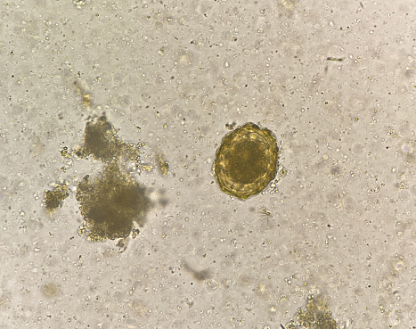 Ascaris lumbricoides  egg human parasite in stool examination.