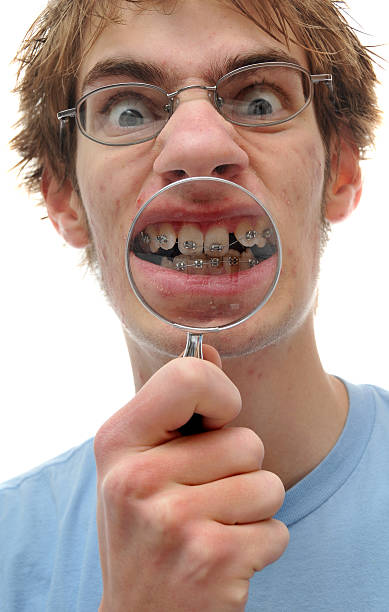 istock Dental Mouth Braces Inspection 146967849