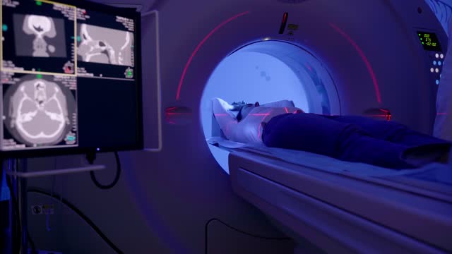 4k video CT scan of brains of woman in medical clinic with blue light. Girl patient is doing computed tomography x-ray examination of tumor in his head with red lines in a CT scan room.