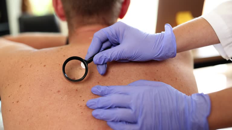 Dermatologist examines patient birthmark with magnifying glass in clinic closeup