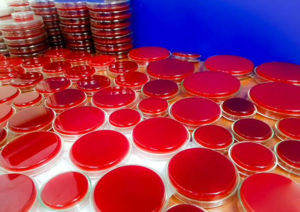 istock Blood agar medium on petri dish, Microbiology laboratory. Antimicrobial culture testing. 1469891033