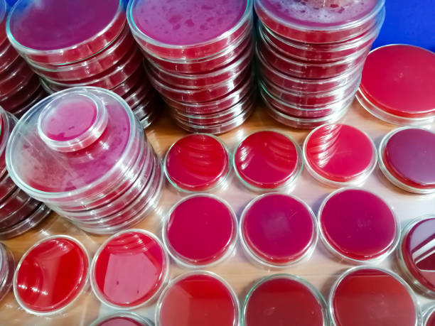 istock Blood agar medium on petri dish, Microbiology laboratory. Antimicrobial culture testing. 1469891051