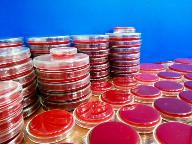 istock Blood agar medium on petri dish, Microbiology laboratory. Antimicrobial culture testing. 1469891060