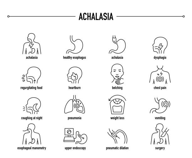 illustrazioni stock, clip art, cartoni animati e icone di tendenza di set di icone vettoriali di acalasia . icone mediche modificabili in linea. - dysphagia