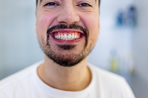 A close-up of a young Caucasian man cheerfully looking at the camera and showing his healthy teeth.