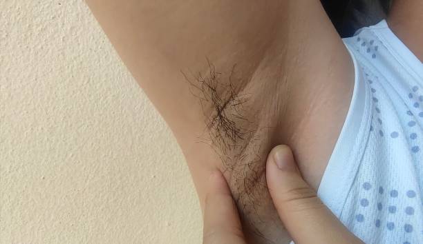 istock Armpit hair and chicken skin underarm. 1470124187