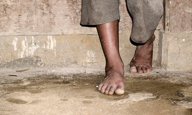sporca piedi - human foot barefoot sole of foot human toe foto e immagini stock