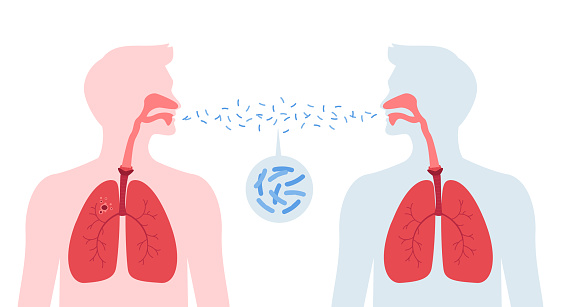 Tuberculosis disease concept. Vector flat healthcare illustration. People silhouette with lung infect other by tb isolated on white background. Design element for health care, education, pulmonology