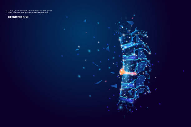 ilustrações de stock, clip art, desenhos animados e ícones de herniated disc injury to the cushioning and connective tissue between vertebrae disk bone back annulus nucleus bulged older cord muscle. low polygon, particle, and triangle style design. - human spine chiropractic adjustment backache human bone