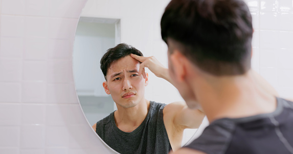 asian man standing in front of mirror is concerned about hair loss or alopecia