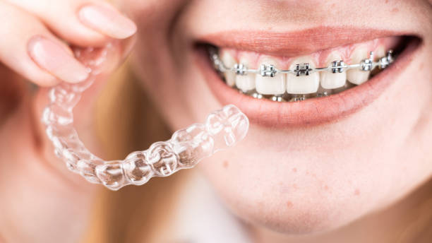 Dental care.Smiling girl with braces on her teeth holds aligners in her hands and shows the difference between them Dental care.Smiling happy girl with braces on her teeth holds aligners in her hands and shows the difference between them braces stock pictures, royalty-free photos & images