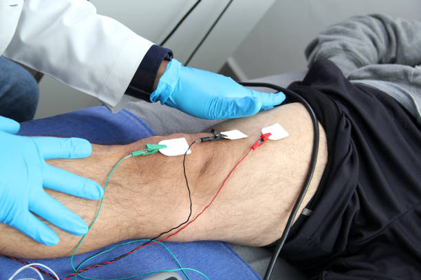 istock Electromyography EMG and Somatosensory Evoked Potential PEV of lower extremities, neurophysiological test applies electrical stimuli near the nerves to explore the rectus femoris muscle 1470645103