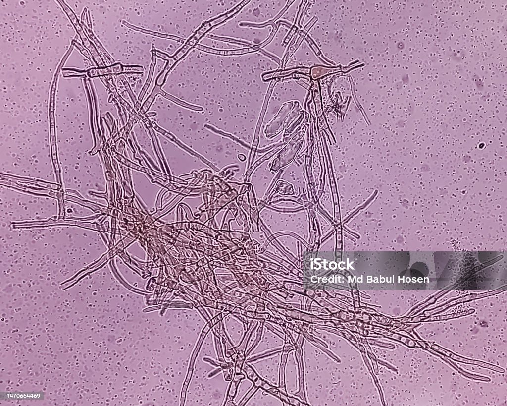 Microscopic fungi Malassezia furfur, showing yeast cells and hyphae. dermatophytes, Nail scraping or skin scraping for fungus test. Microscopic fungi Malassezia furfur, showing yeast cells and hyphae. dermatophytes, Nail scraping or skin scraping for fungus test in microbiology laboratory. Yeast Stock Photo