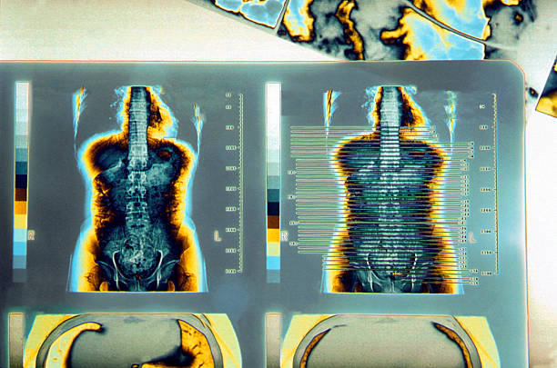 Photographs of human cat scans to search for illnesses stock photo