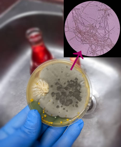 istock Malt Extract Agar in Petri dish using for growth media to isolate and cultivate yeasts, molds and fungal testing from neil scraping samples. Neil scraping for fungus culture with microscopy. 1470721874
