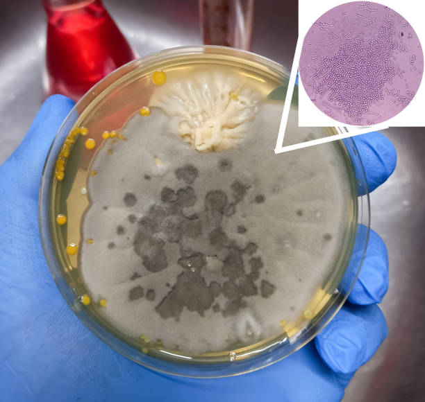 istock Malt Extract Agar in Petri dish using for growth media to isolate and cultivate yeasts, molds and fungal testing from neil scraping samples. Neil scraping for fungus culture with microscopy. 1470721944
