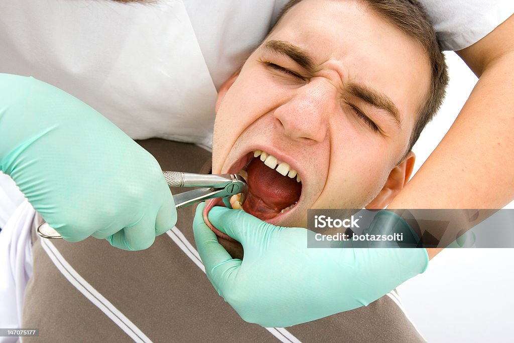 Estrazione dentale - Foto stock royalty-free di Attrezzatura