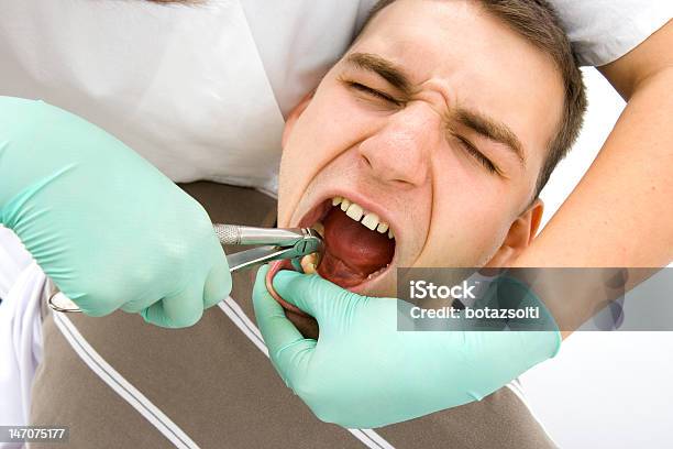 Foto de Extração De Dentista e mais fotos de stock de Boca Humana - Boca Humana, Dente Humano, Dentista