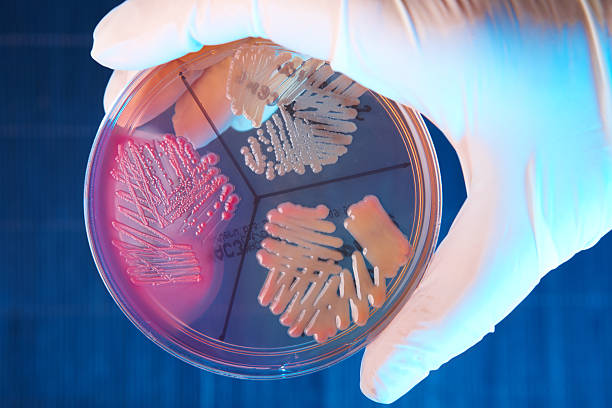 bactéria patológicas - bacterial colonies imagens e fotografias de stock