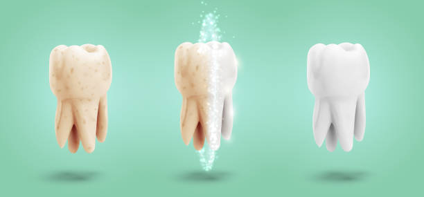 illustrazioni stock, clip art, cartoni animati e icone di tendenza di insieme vettoriale di tre molari. pulizia, cura e protezione dei denti - equal opportunity flash