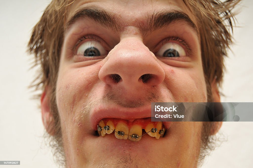 Hideous Monstrous Man Hideous Monstrous Man staring at the camera with wide eyes, yellow crooked teeth with braces and huge nose. Eww! Ugly. Ugliness Stock Photo