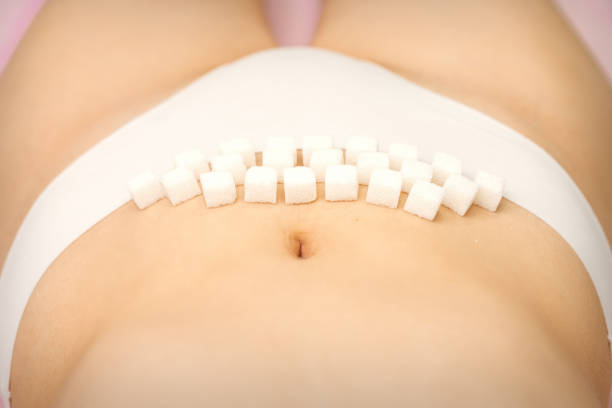 the concept of epilation, waxing, and intimate hygiene. sugar cubes lying in a row on the bikini zone of a young white woman, close up. - panties underwear transparent women imagens e fotografias de stock