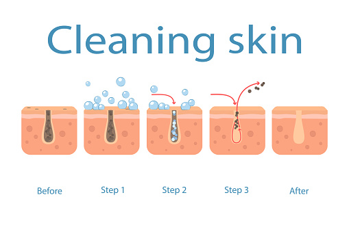Skin cleaning steps on clogged face, facial skin care, pore cleaning.