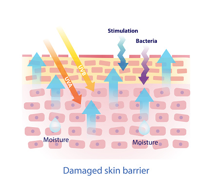 Damaged skin barrier vector on white background. The weak skin barrier make tight arrangement between the skin cells is lost. This allows external irritants to get in easier and lead to more water leaving skin. Skin care and beauty concept illustration.