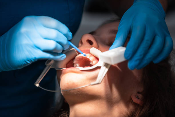 istock Dentist appointment at a dental clinic, placing braces locks on the teeth and pulling the archwire to fix it 1471048485