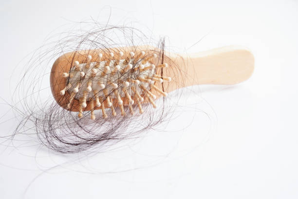 istock Hair loss fall with comb brush isolated on white background. 1471133590