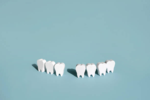 istock A model of teeth on a blue background with a missing front tooth . 1471256353