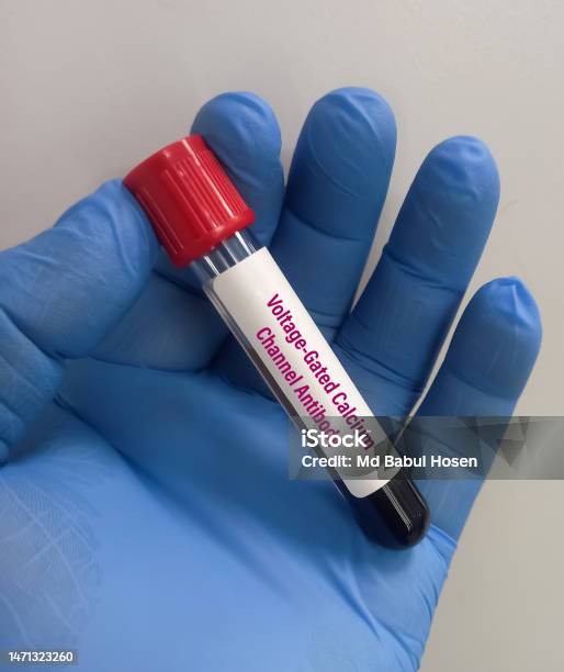 Blood Sample For Voltagegated Calcium Channel Test To Diagnosis Of Blood Sample For Voltagegated Calcium Channel Test To Diagnosis Of