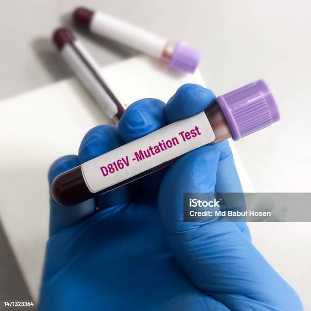 Blood Sample For Kit Mutation Testing To Diagnosis Of Acute Myeloid Blood Sample For Kit Mutation Testing To Diagnosis Of Acute Myeloid