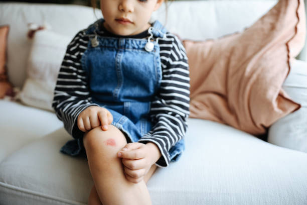 Child's feet with injuries and scratches. Kid with injured knees and wounds on a gray background. Close-up of young child girl bruised damaged injured knees after falling with old scars and fresh blood. Children traumas, accidents and treatment, problems of growing-up concept knee contusion bruised knee stock pictures, royalty-free photos & images